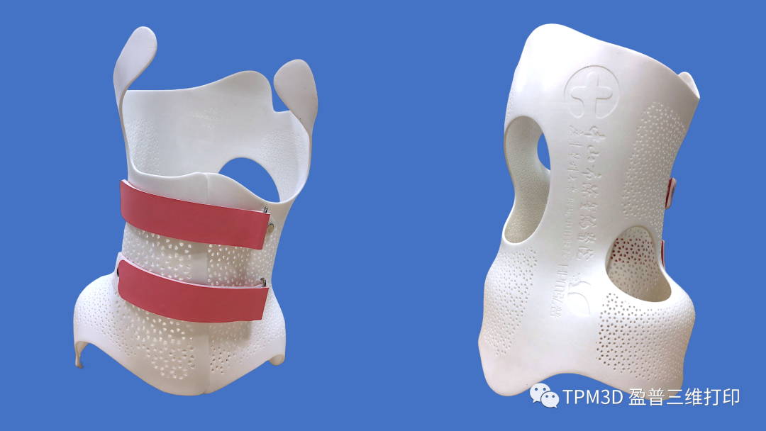 盈普SLS 3D打印脊柱側(cè)彎矯形器